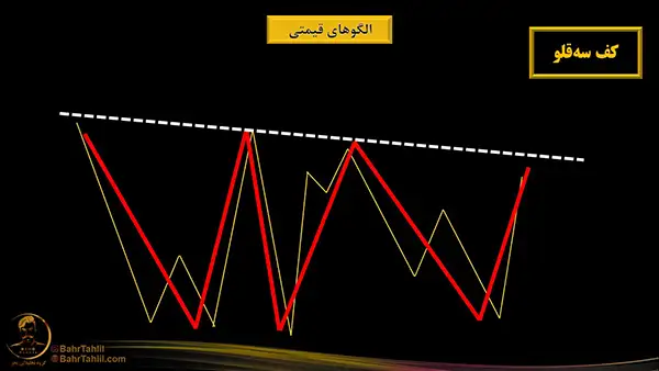 کف سه قلو - حرکت امواج الیوت - دکتر محمد بحرینی